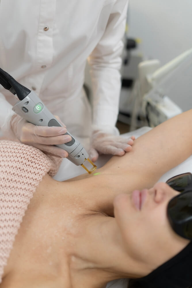 arms laser hair removal in thane